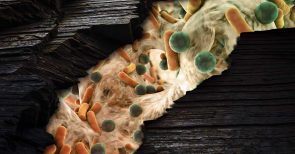 Vor dem Herbst: Wie können wir unser Immunsystem stärken und schützen? Vor dem Herbst: Wie können wir unser Immunsystem stärken und schützen?
