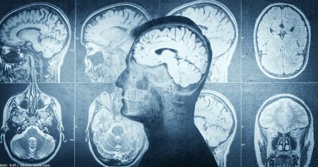 Optogenetik: Wie ein Stanford-Professor unsere Gehirne kontrollieren will