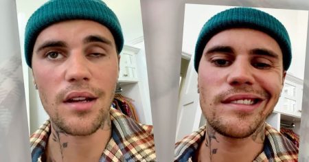 Justin Bieber: Gesichtslähmung durch Impfung?